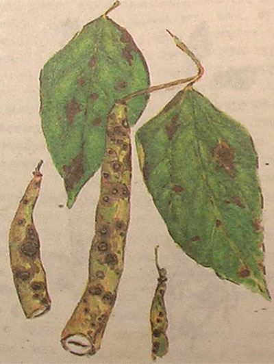 Антракноз овощной фасоли на листьях и бобах
